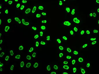Anti-SNRPA antibody used in Immunocytochemistry/ Immunofluorescence (ICC/IF). GTX55804