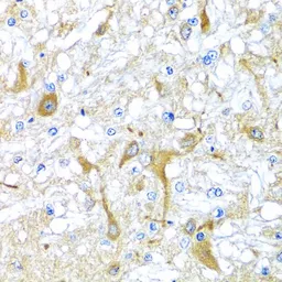 Anti-SULT1A1 antibody used in IHC (Paraffin sections) (IHC-P). GTX55811