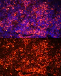 Anti-TLR8 antibody used in IHC (Paraffin sections) (IHC-P). GTX55817