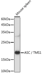 Anti-TMS1 antibody used in Western Blot (WB). GTX55818