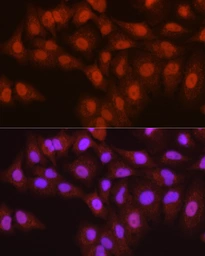 Anti-TMS1 antibody used in Immunocytochemistry/ Immunofluorescence (ICC/IF). GTX55818