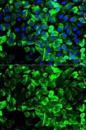 Anti-Tropomyosin 1 antibody used in Immunocytochemistry/ Immunofluorescence (ICC/IF). GTX55822