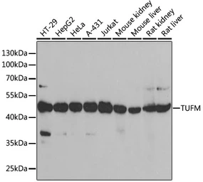 Anti-TUFM antibody used in Western Blot (WB). GTX55825