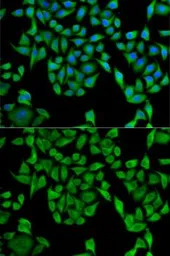 Anti-UGT1A antibody used in Immunocytochemistry/ Immunofluorescence (ICC/IF). GTX55835