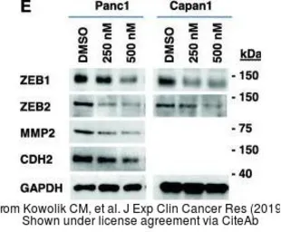 Anti-ZEB1 antibody used in Western Blot (WB). GTX55847