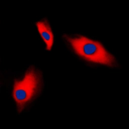 Anti-gamma 2 Actin antibody used in Immunocytochemistry/ Immunofluorescence (ICC/IF). GTX55849