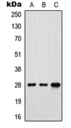 Anti-FOLR3 antibody used in Western Blot (WB). GTX55857
