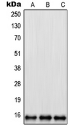 Anti-RPL35 antibody used in Western Blot (WB). GTX55931