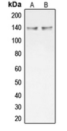 Anti-COL20A1 antibody used in Western Blot (WB). GTX55969