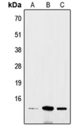 Anti-BRI3 antibody used in Western Blot (WB). GTX56005