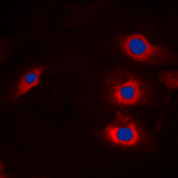 Anti-NEDL2 antibody used in Immunocytochemistry/ Immunofluorescence (ICC/IF). GTX56038