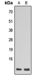 Anti-RPL39 antibody used in Western Blot (WB). GTX56118