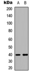 Anti-LMTK3 antibody used in Western Blot (WB). GTX56134
