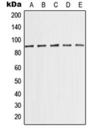 Anti-PCQAP / MED15 antibody used in Western Blot (WB). GTX56188