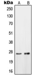 Anti-OTUB2 antibody used in Western Blot (WB). GTX56189