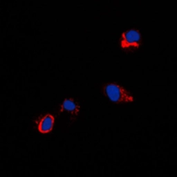 Anti-Coxsackie Adenovirus Receptor antibody used in Immunocytochemistry/ Immunofluorescence (ICC/IF). GTX56276