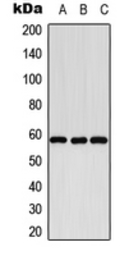 Anti-CYP8B1 antibody used in Western Blot (WB). GTX56292