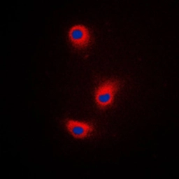 Anti-TRP2 antibody used in Immunocytochemistry/ Immunofluorescence (ICC/IF). GTX56299