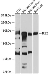 Anti-IRS2 antibody used in Western Blot (WB). GTX57160