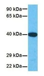 Anti-SOX18 antibody used in Western Blot (WB). GTX57216
