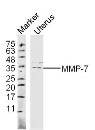 Anti-MMP7 antibody used in Western Blot (WB). GTX57231