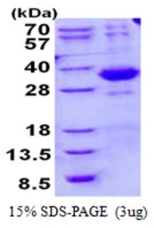 Human SPSB2 protein, His tag. GTX57243-pro