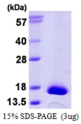 Human TRP14 protein, His tag. GTX57246-pro