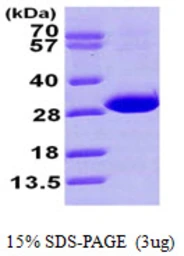 Human CBR4 protein, His tag. GTX57250-pro