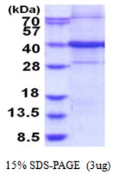 Human ARHGEF39 protein, His tag. GTX57252-pro