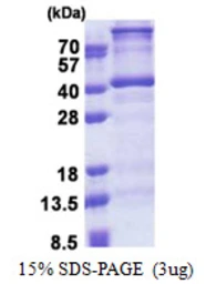 Human DNTTIP1 protein, His tag. GTX57303-pro