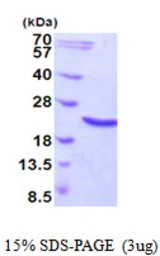 Human Hsp20 protein, His tag. GTX57324-pro