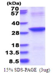 Human ABHD12B protein, His tag. GTX57355-pro