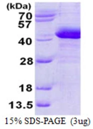 Human ZADH1 protein, His tag. GTX57356-pro