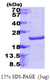 Human NUDT10 protein, His tag. GTX57378-pro