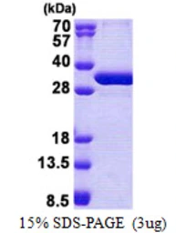 Human NSMCE1 protein, His tag. GTX57382-pro