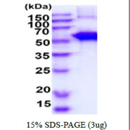 Mouse SLA/LP protein, His tag. GTX57386-pro