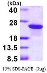 Human ARL5B protein, His tag. GTX57391-pro