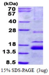 Human XAGE1B protein, His tag. GTX57450-pro