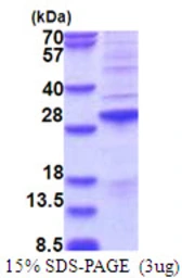 Human SSX2 protein, His tag. GTX57454-pro