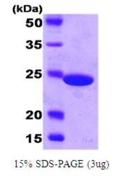 E. coli Carbonic Anhydrase protein, His tag. GTX57462-pro