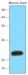 Anti-SNAP25 antibody [4E11] used in Western Blot (WB). GTX57559