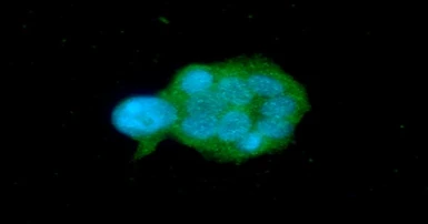 Anti-OSTF1 antibody [AT9G4] used in Immunocytochemistry/ Immunofluorescence (ICC/IF). GTX57564