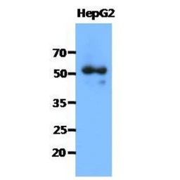 Anti-Syntrophin alpha 1 antibody [AT1E1] used in Western Blot (WB). GTX57590
