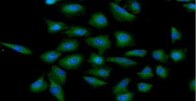 Anti-HIP antibody [AT5C6] used in Immunocytochemistry/ Immunofluorescence (ICC/IF). GTX57598