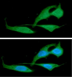 Anti-RAIDD antibody [AT14G8] used in Immunocytochemistry/ Immunofluorescence (ICC/IF). GTX57605