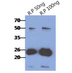 Anti-RAIDD antibody [AT14G8] used in Western Blot (WB). GTX57605