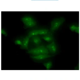 Anti-COMMD7 antibody [AT49B5] used in Immunocytochemistry/ Immunofluorescence (ICC/IF). GTX57616