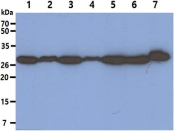 Anti-PSME1 antibody [AT12H3] used in Western Blot (WB). GTX57620