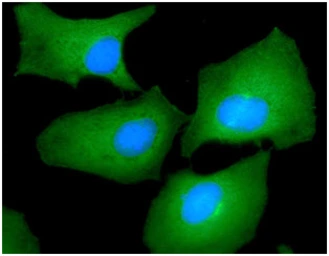 Anti-Fascin 1 antibody [AT13D2] used in Immunocytochemistry/ Immunofluorescence (ICC/IF). GTX57621