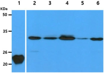 Anti-Calpain S1 antibody [AT1D11] used in Western Blot (WB). GTX57626